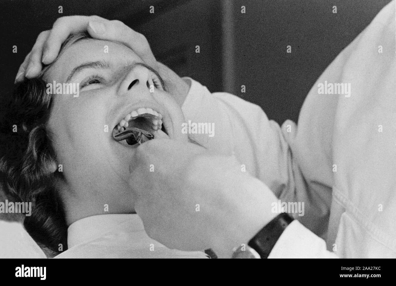At the dentist in the 1940s. A woman patient is having one of her teeth pulled. The dentist has a instrument in her mouth Stock Photo