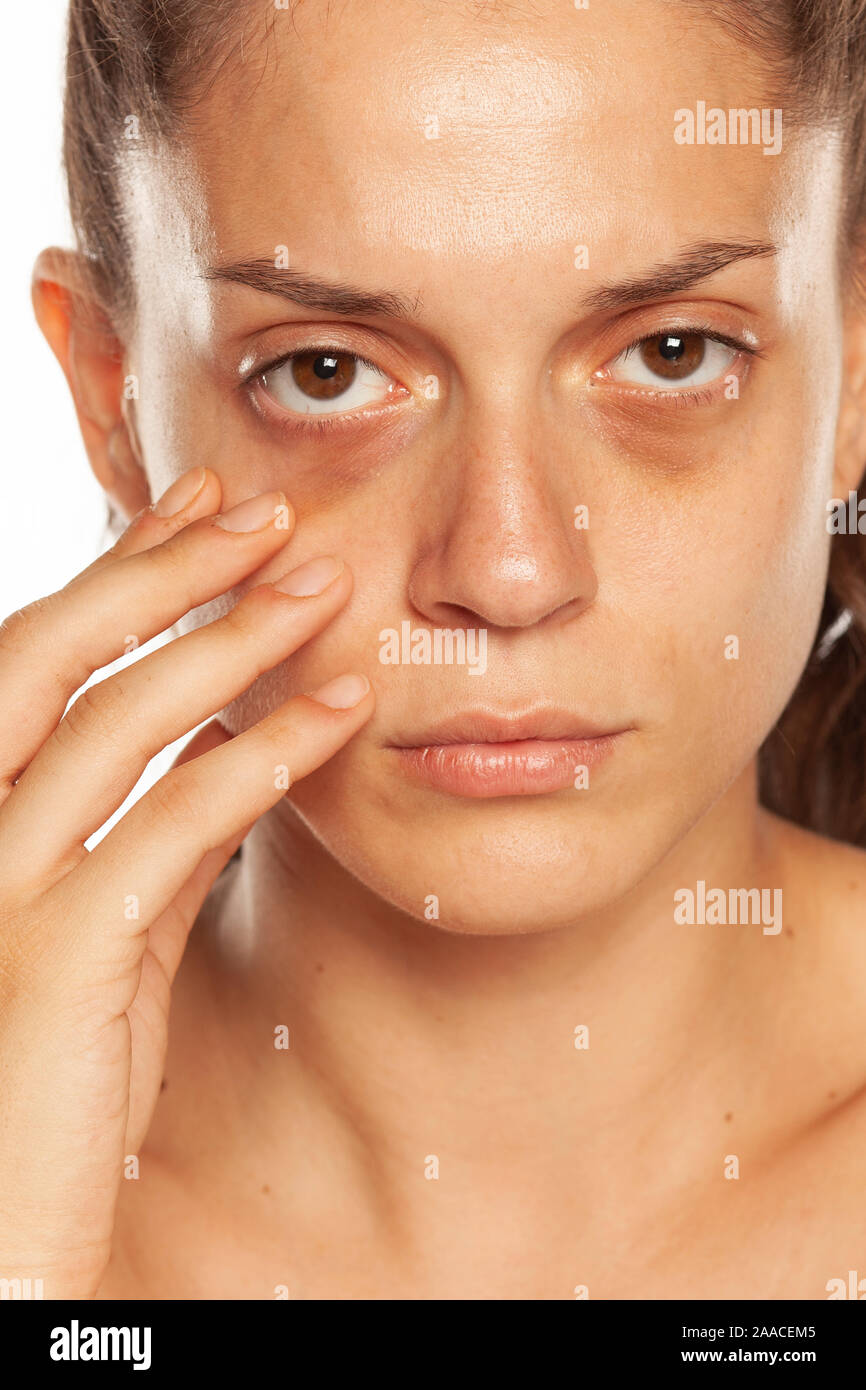 With bags under her eyes hires stock photography and images  Alamy