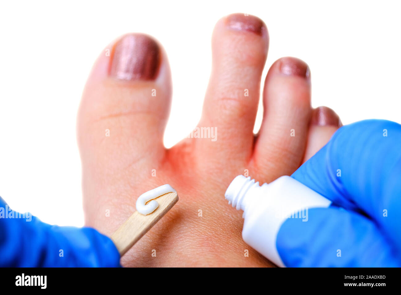 Medical Pedicure Process Breakdown - Feet First Clinic
