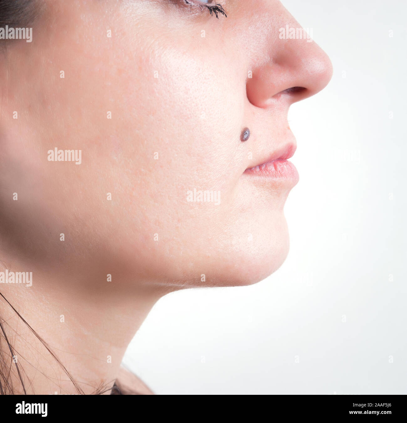 Mole On The Face Of Woman Stock Photo Alamy https www alamy com mole on the face of woman image333477262 html