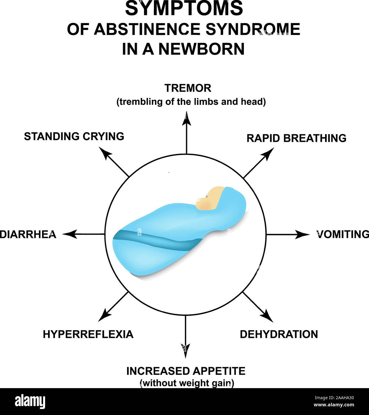 Symptoms of abstinence syndrome in newborns. Infographics. withdrawal