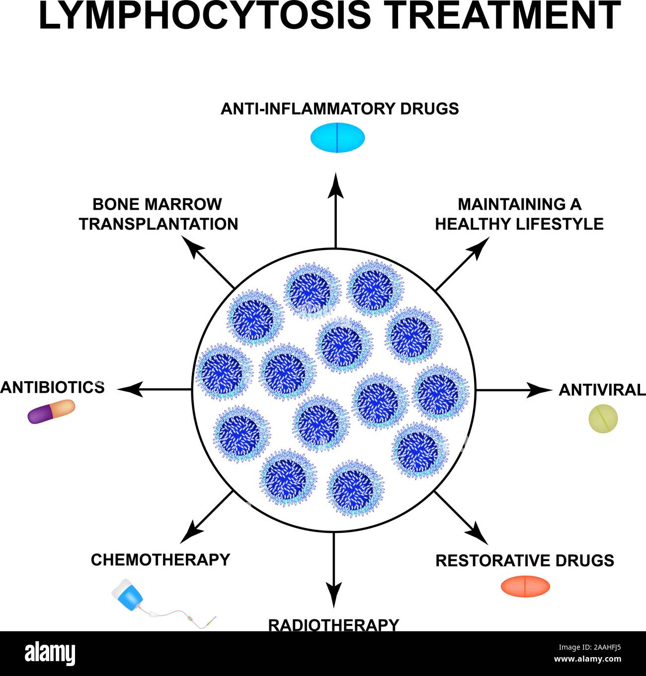 Lymphocyte Infection Lymphocytosis treatment. The increase in lymphocytes in the blood. Cell ...