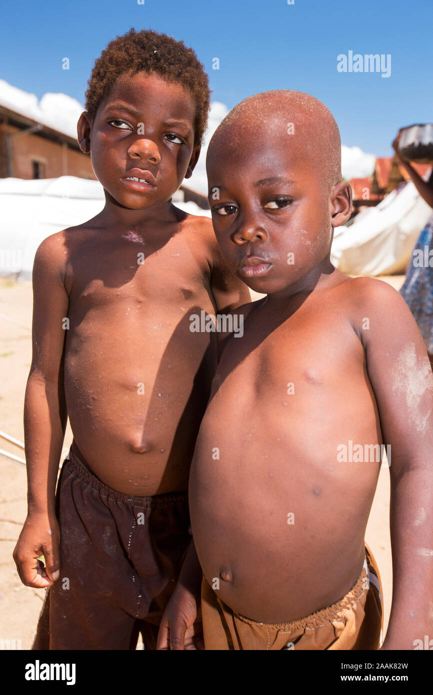 Malnourished children in a refugee camp in Bangula. Malawi is one of the poorest countries in the world with high levels of child hunger, exacerbated Stock Photo