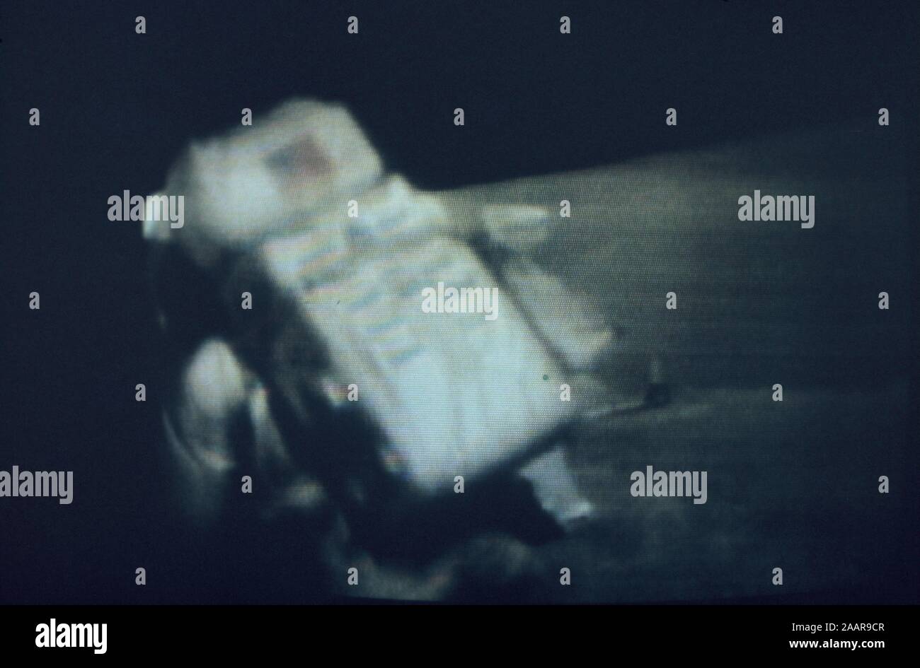 Teleclip - Buzz Aldrin stumbles on Moon surface - Apollo 11 photo taken during live broadcast/s circa 1969-72 Stock Photo