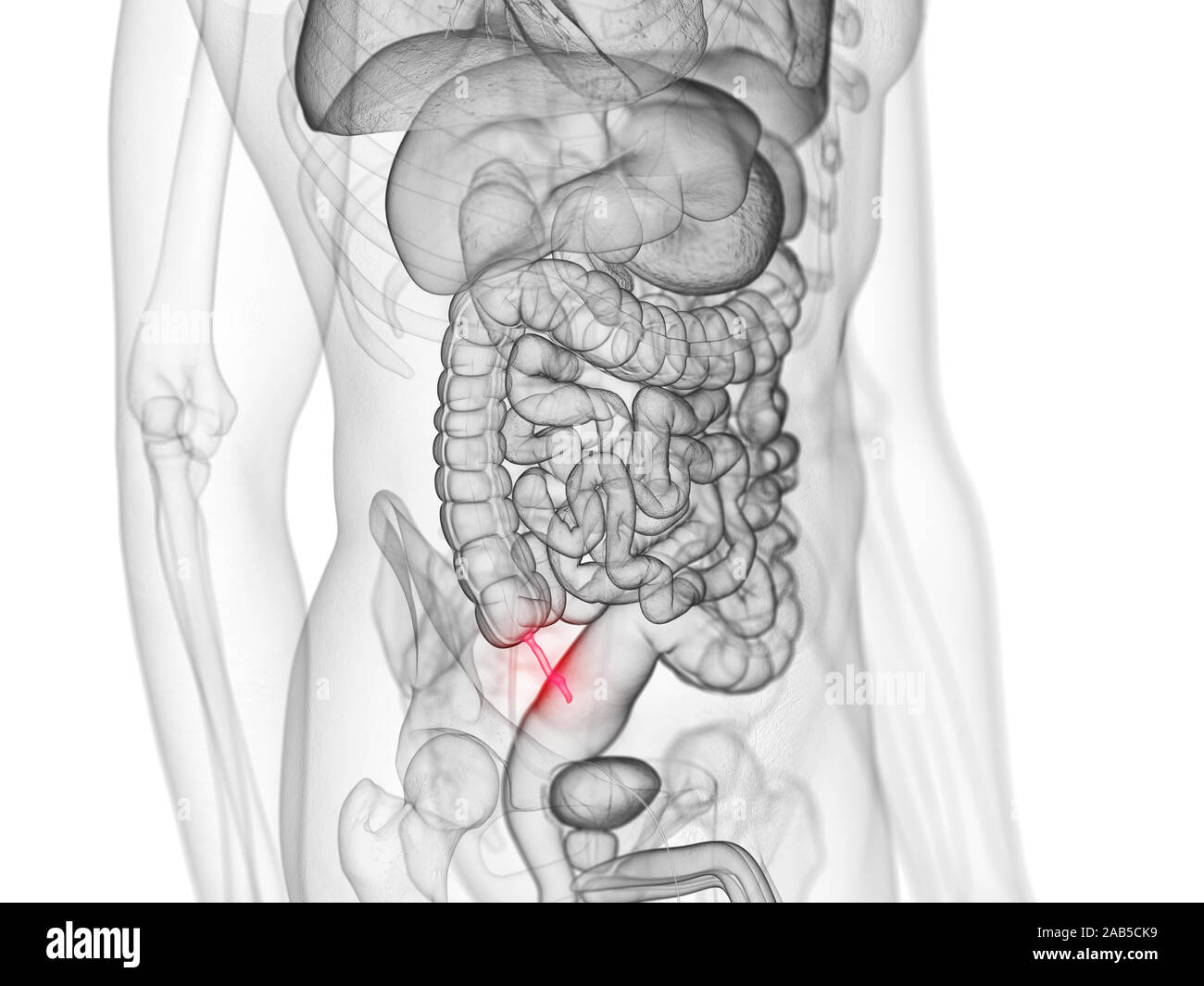 Vermiform appendix hi-res stock photography and images - Alamy