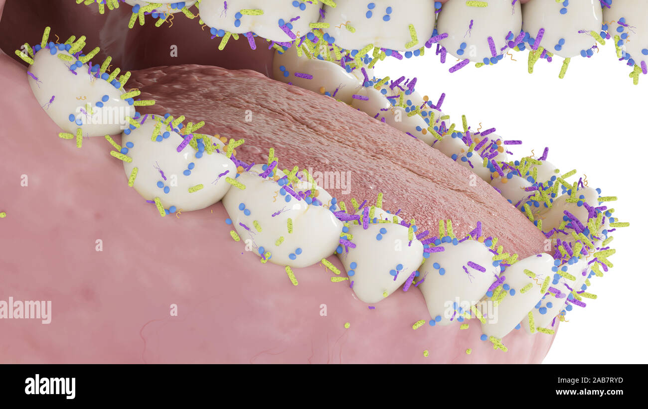 3d rendered conceptual illustration showing the bacteria on the teeth Stock Photo