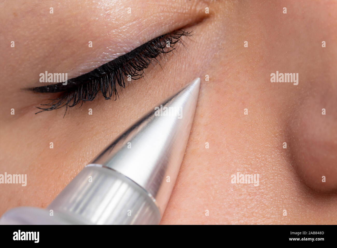 Macro close up of woman having noninvasive cosmetic facial with plasma pen. Cone shaped device doing skin tightening under eye. Stock Photo
