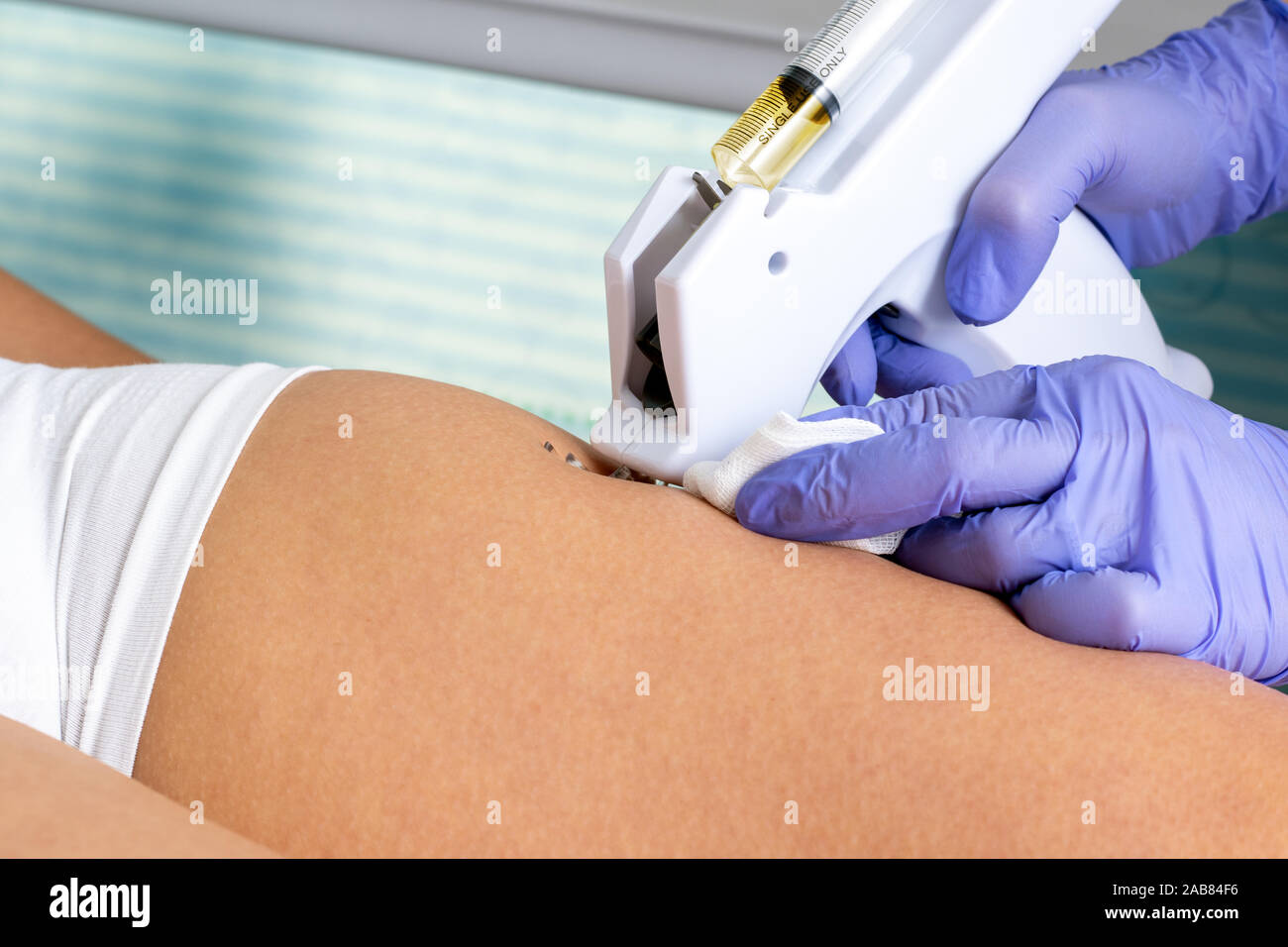Extreme close up detail of therapist doing mesotherapy on female upper thigh with micro needle gun. Stock Photo