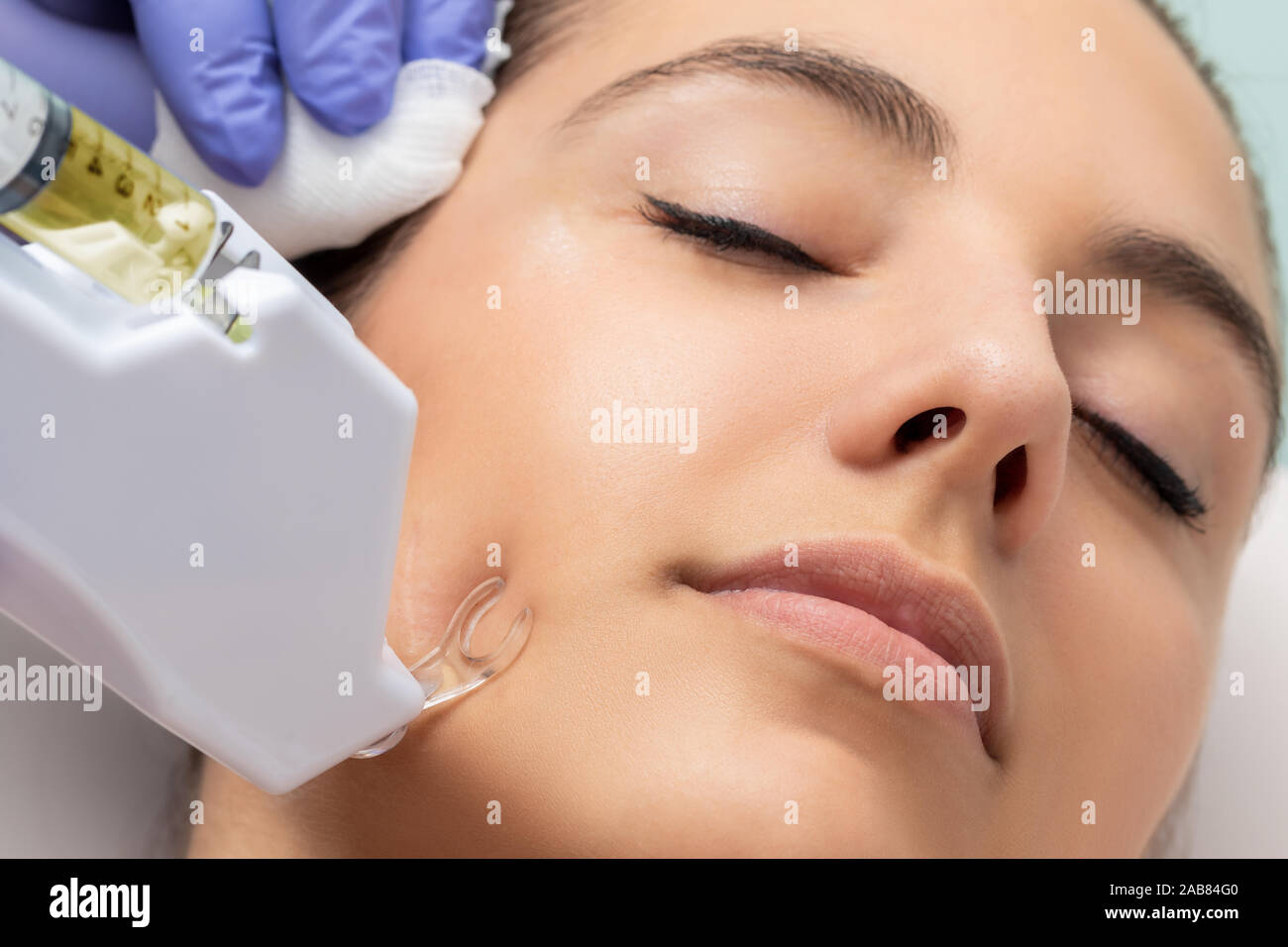 Therapist doing micro needling non invasive surgery on woman's cheek to remove scars. Stock Photo