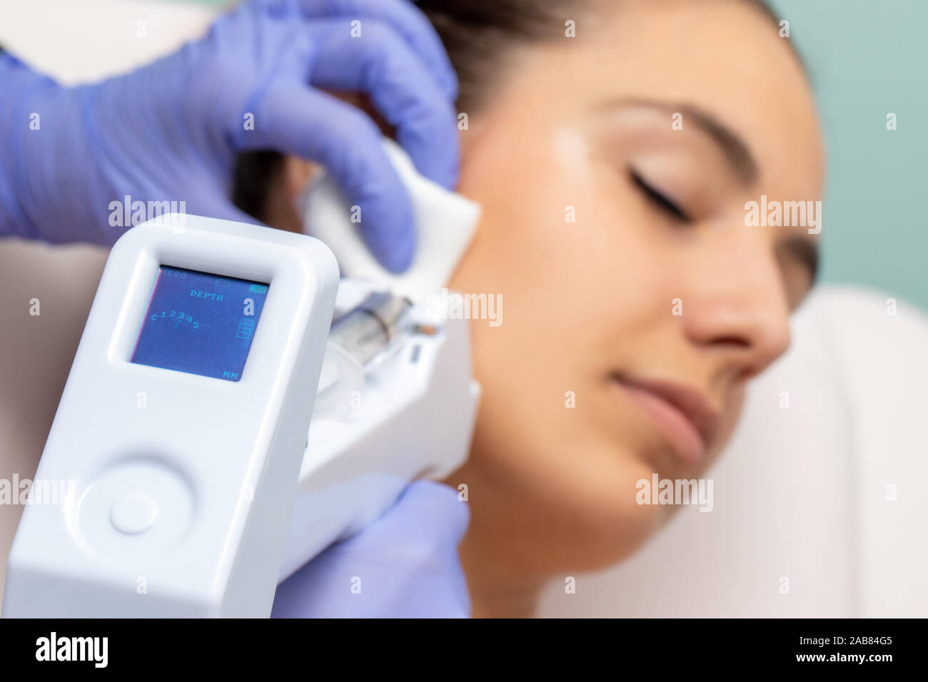 Micro needling technology used on young woman. Device with digital screen indicating depth applied on skin. Stock Photo