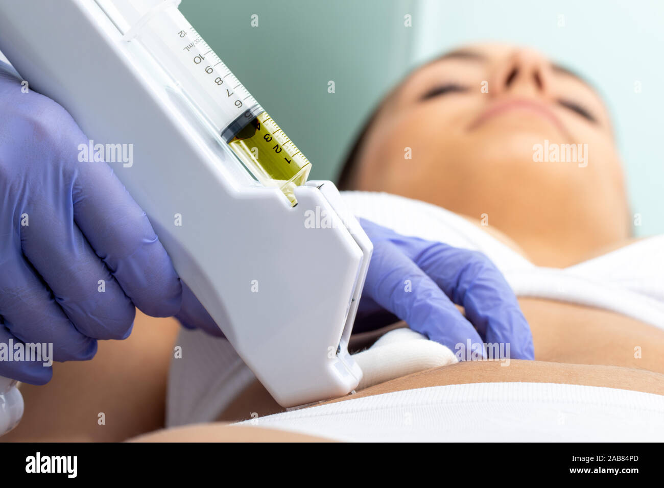 Therapist doing non-surgical cosmetic medicine treatment on female tummy with micro needle. Stock Photo