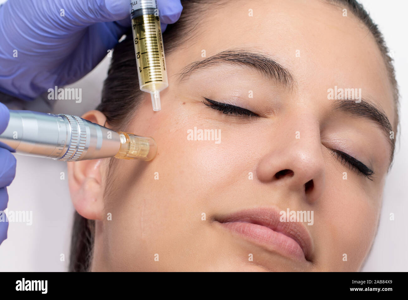 Close up of young woman having cosmetic mesotherapy facial. Therapist injecting pharmaceuticals with derma pen on cheek. Stock Photo