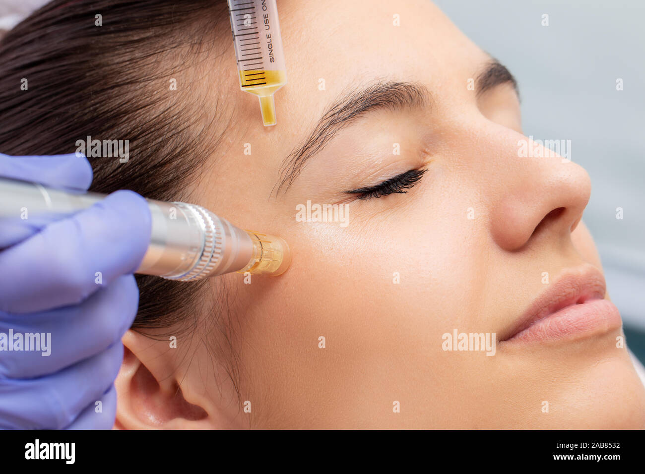 Macro close up of therapist injecting enzymes and with derma pen around woman's eyes. Stock Photo