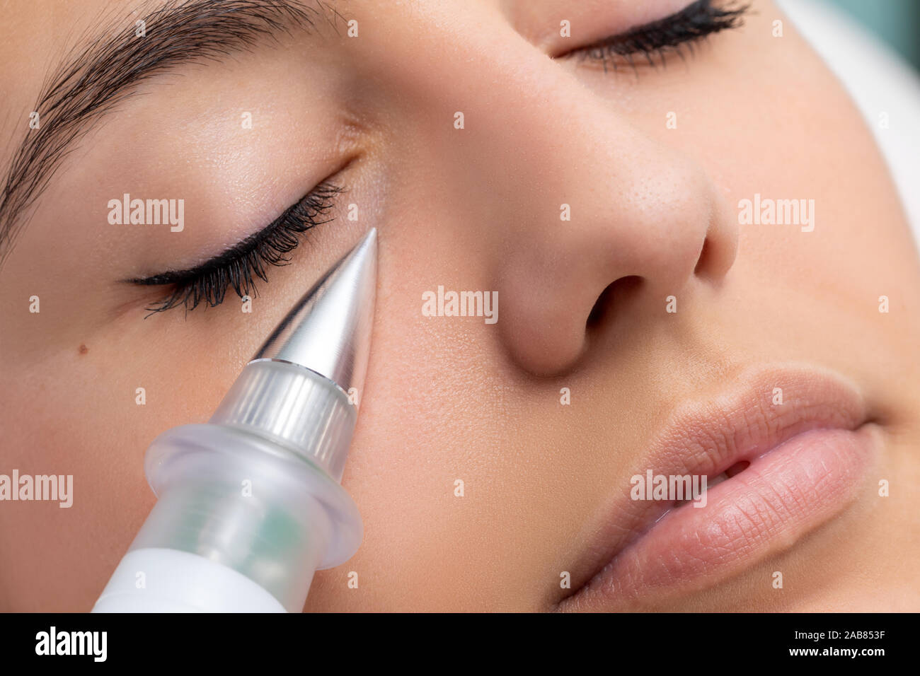 Macro close up of woman having noninvasive cosmetic facial with plasma pen. Cone shaped device doing skin tightening under eye. Stock Photo