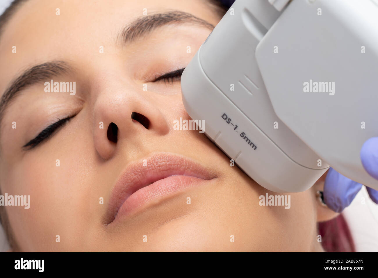 Woman receiving high intensity focused ultrasound treatment on face. Therapist doing cosmetic plasma lift on cheek with ultrasonic device. Stock Photo