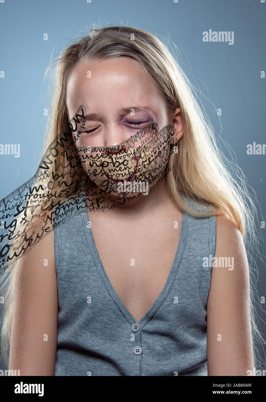 Upset. Sad little girl with bloodshot, bruised eyes and covered mouth