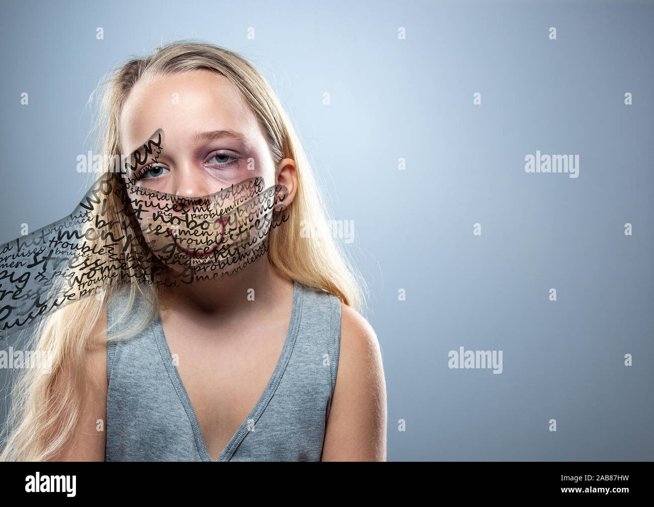 Tired. Sad little girl with bloodshot, bruised eyes and covered mouth. Concept of child violence, domestic abuse. Depressed being victim of parents. Illusion of childhood. Invisible male hand. Design. Stock Photo