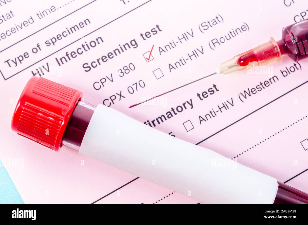 Sample blood collection tube with HIV test label on HIV infection