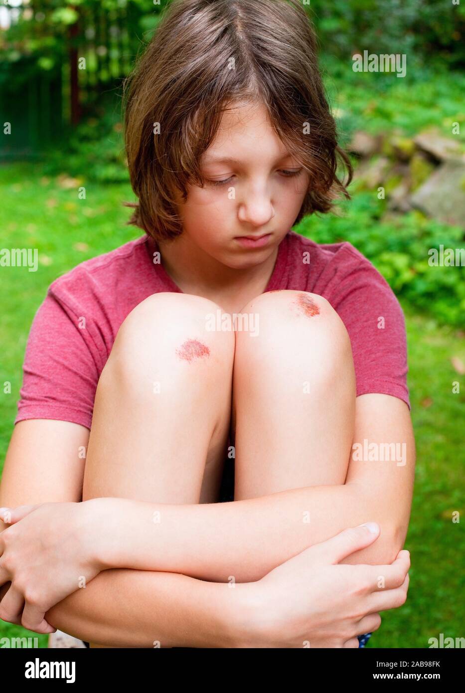 Boy with bruised knee caps in the garden. Stock Photo