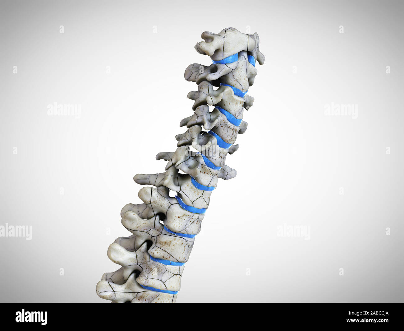 3d rendered medically accurate illustration of a broken spine Stock Photo