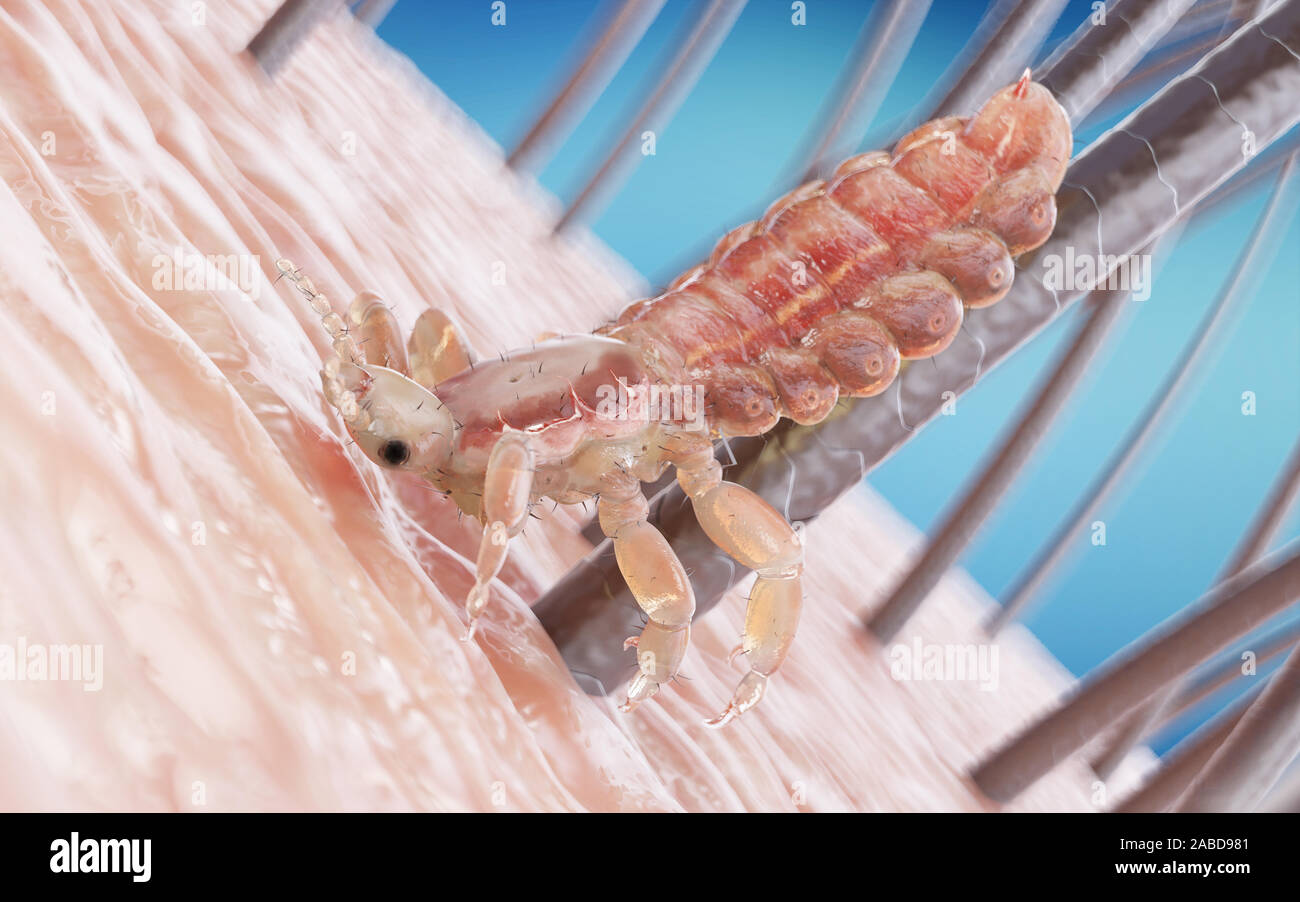 3d rendered medically accurate illustration of a head louse Stock Photo
