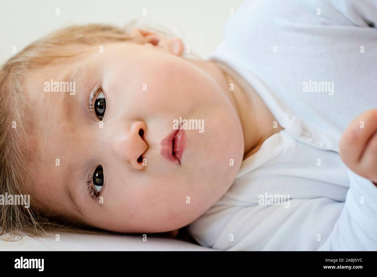 Portrait of a baby with cerebral palsy lying on bed. Special needs