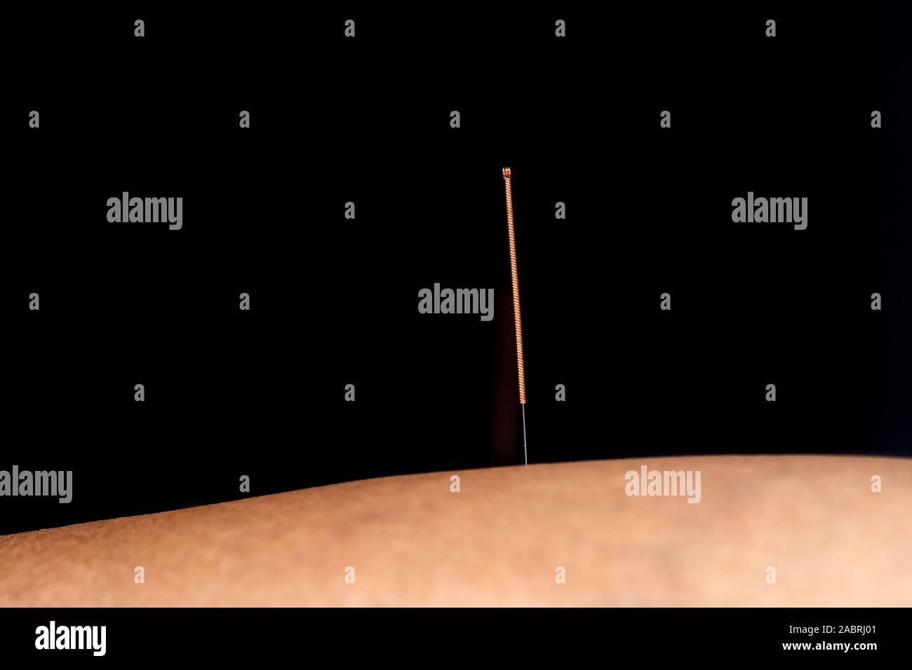 Acupuncture legs hires stock photography and images Alamy