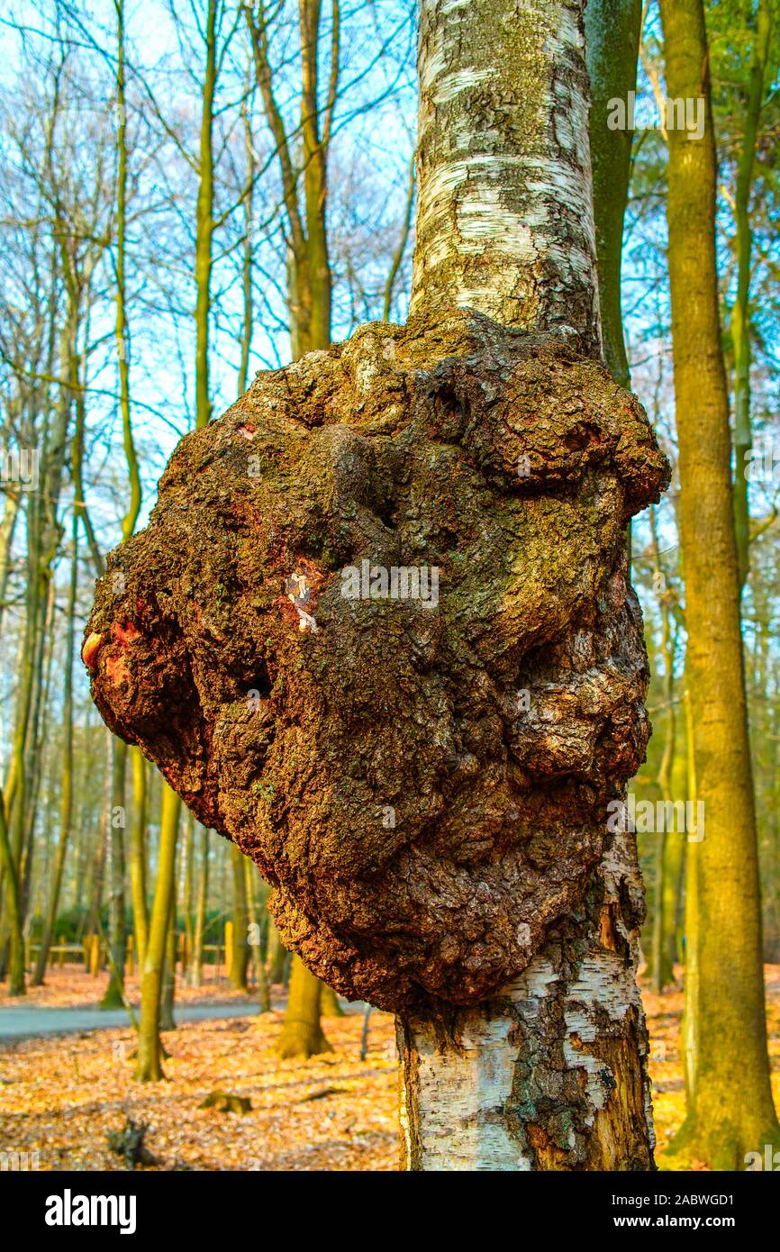 grosse wucherung am birkenstamm, moeglicherweise durch viren oder dem bacterium agrobacterium tumefaciens verursacht; das lebhafte maserholz wird oftm Stock Photo