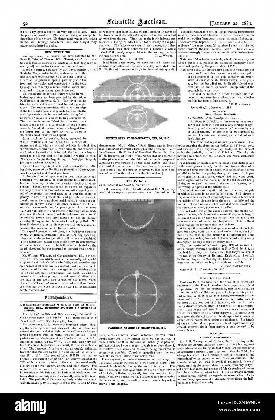 A Remarkably Brilliant Meteor as Seen at Bloom ington Ind. December 30 from 8 &Clock to  o'clock. The Parhelia. PARHELIA AS SEEN AT JERSEYVILLE ILL. Magnificent Parhelia. Restoring the Dead. -of I  -s A Case of Lencoderma. METEOR SEEN AT BLOOMINGTON DEC. 30 1880., scientific american, 1881-01-22 Stock Photo
