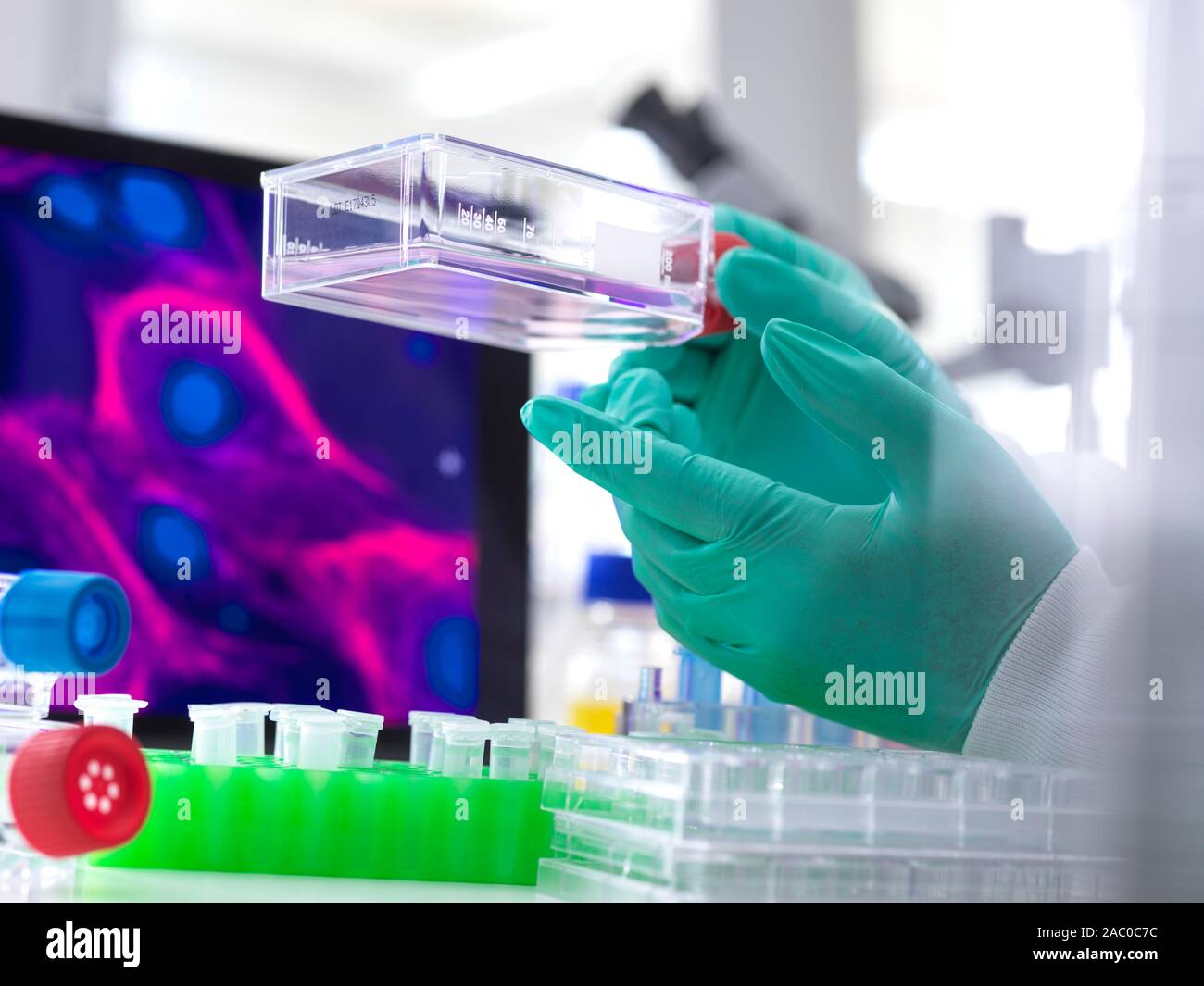 Researcher holding a flask containing cells cultivated in red growth medium. A micrograph of a cell is on the monitor in the background. Stock Photo