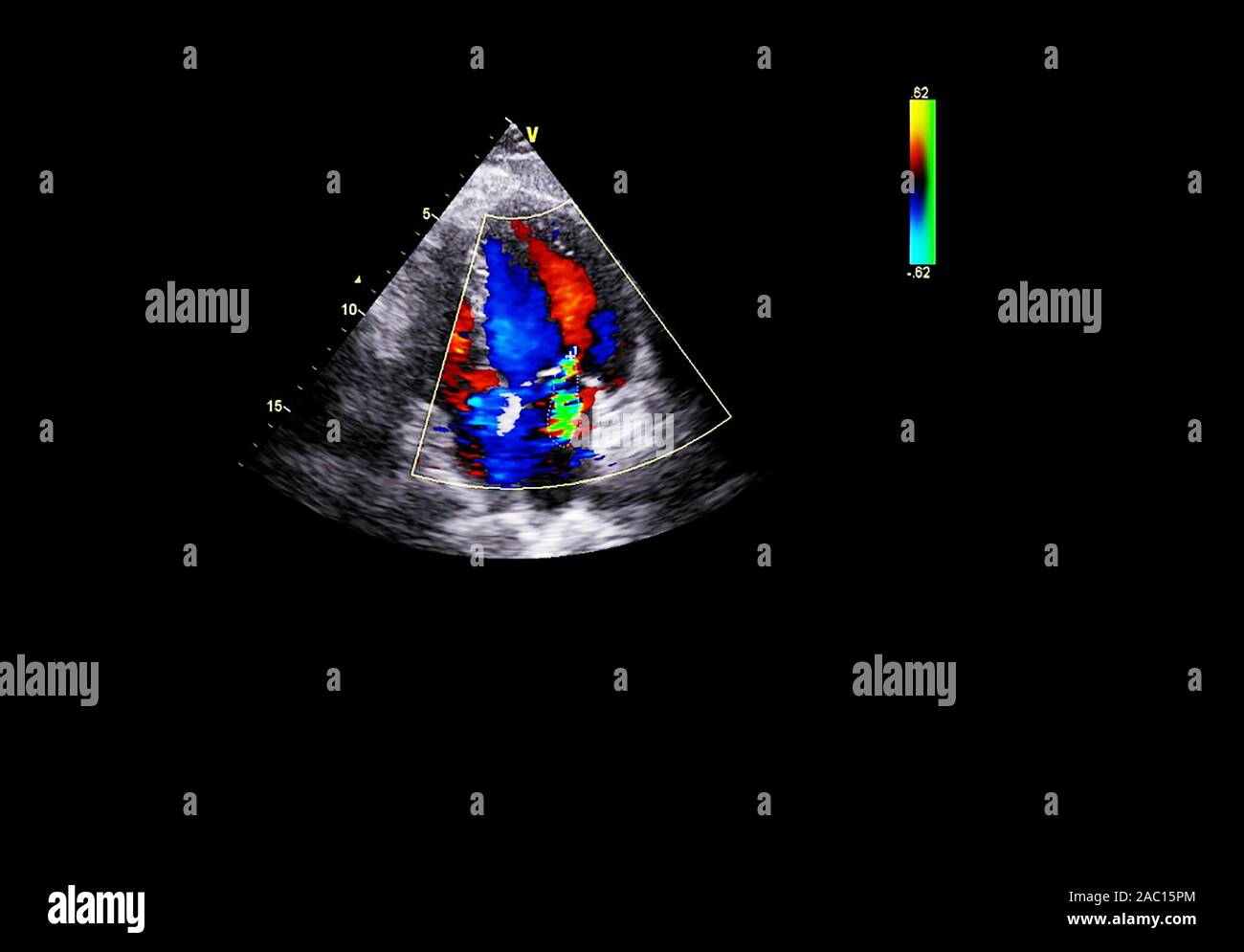 Screen of an ultrasound machine with a heart image Stock Photo - Alamy