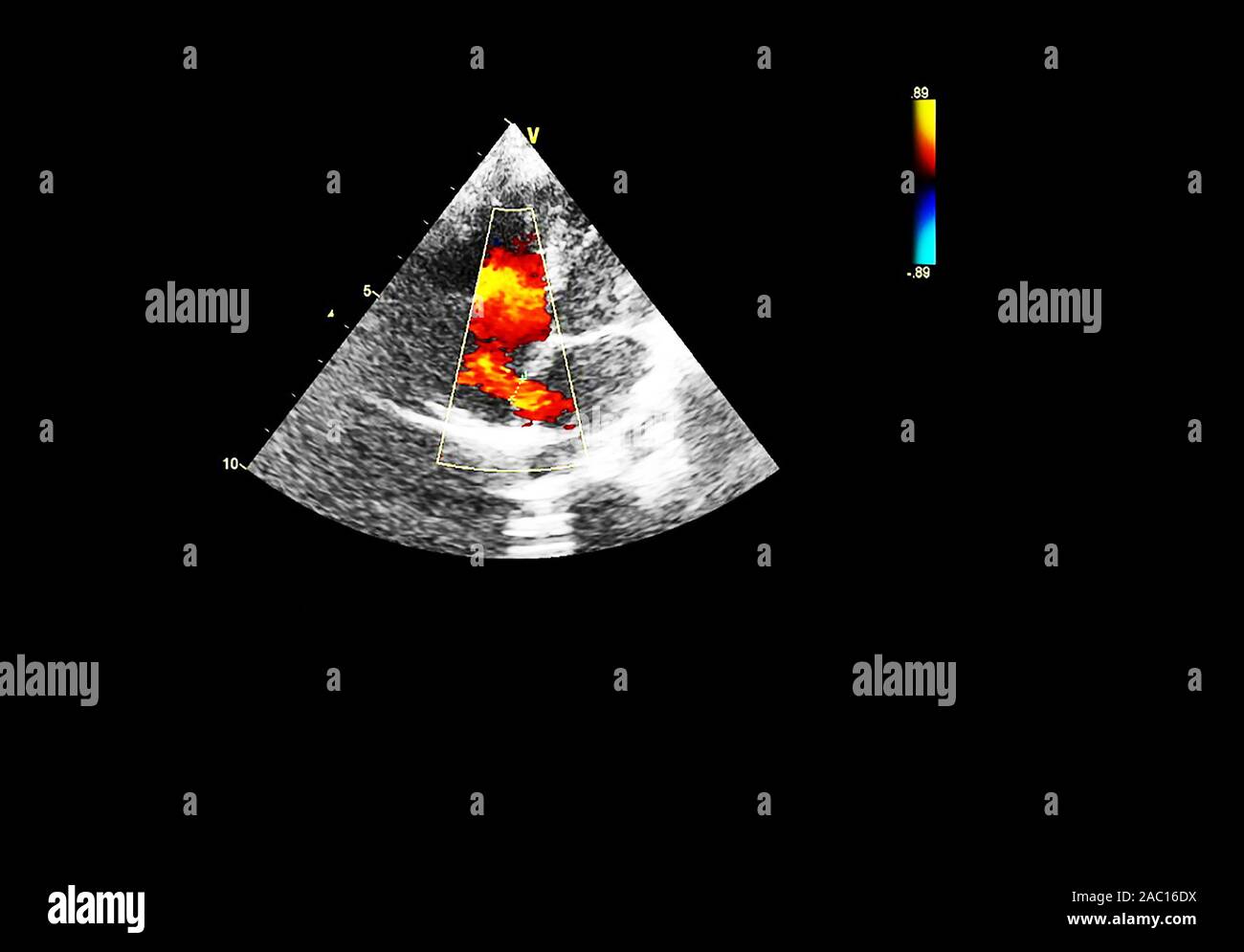 Screen of an ultrasound machine with a heart image Stock Photo - Alamy