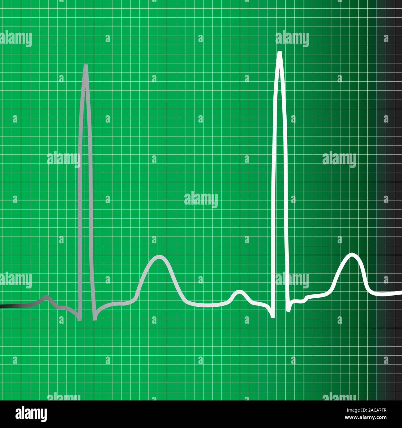 Green ecg hi-res stock photography and images - Alamy