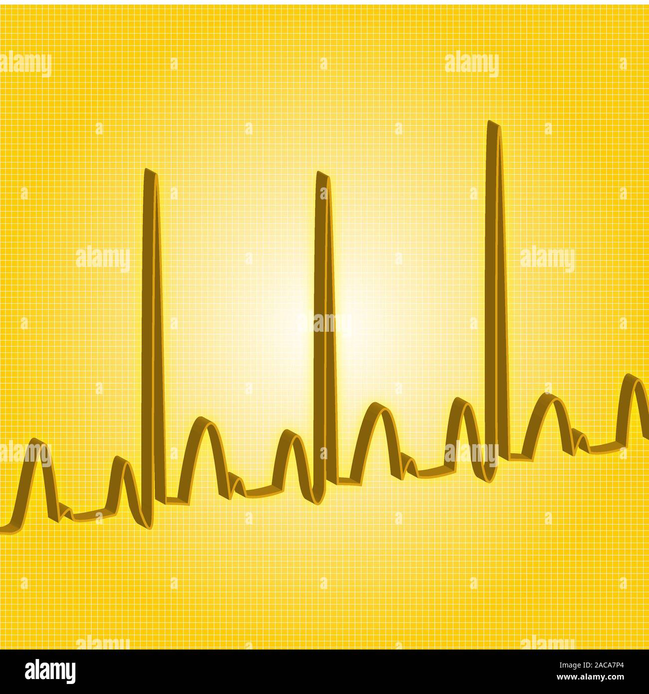 Exercise heartbeat hires stock photography and images Alamy