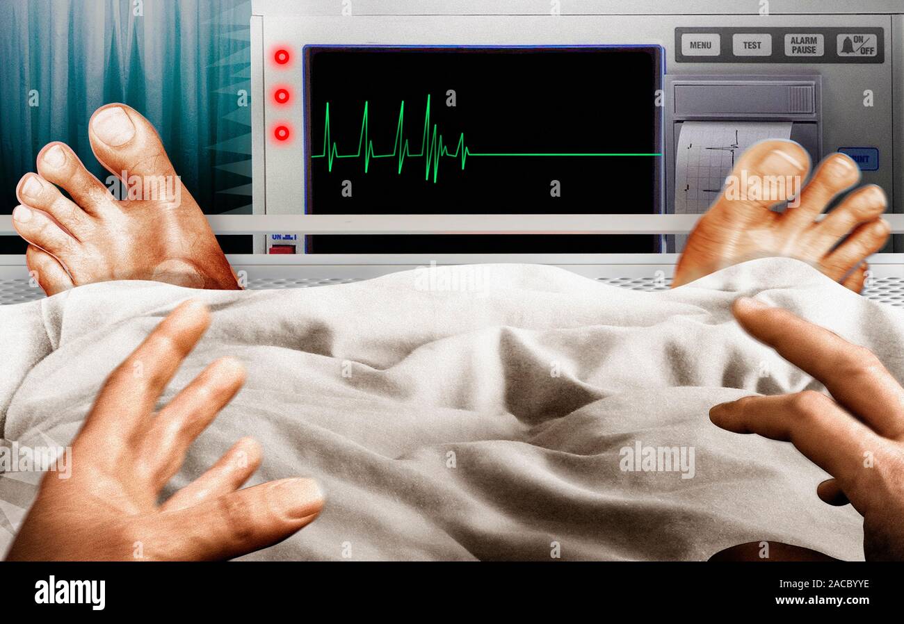 Frightened man in hospital bed seeing flatline pulse trace on monitor Stock Photo