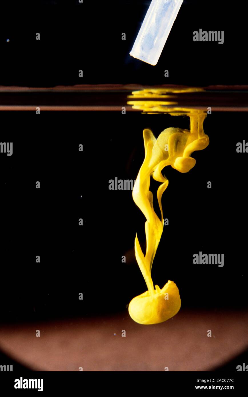 Precipitation of lead iodide. A yellow precipitate of lead iodide