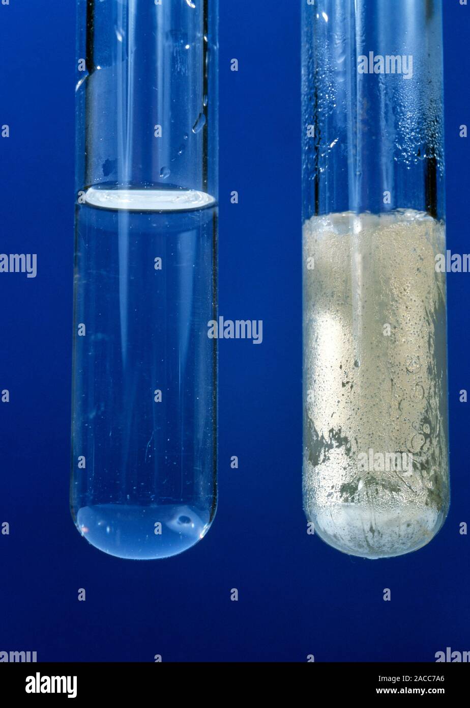 Silver mirror test. Tollen's reagent reacted with an aldehyde produces a silver mirror (right). This is a diagnostic test used to distinguish between Stock Photo