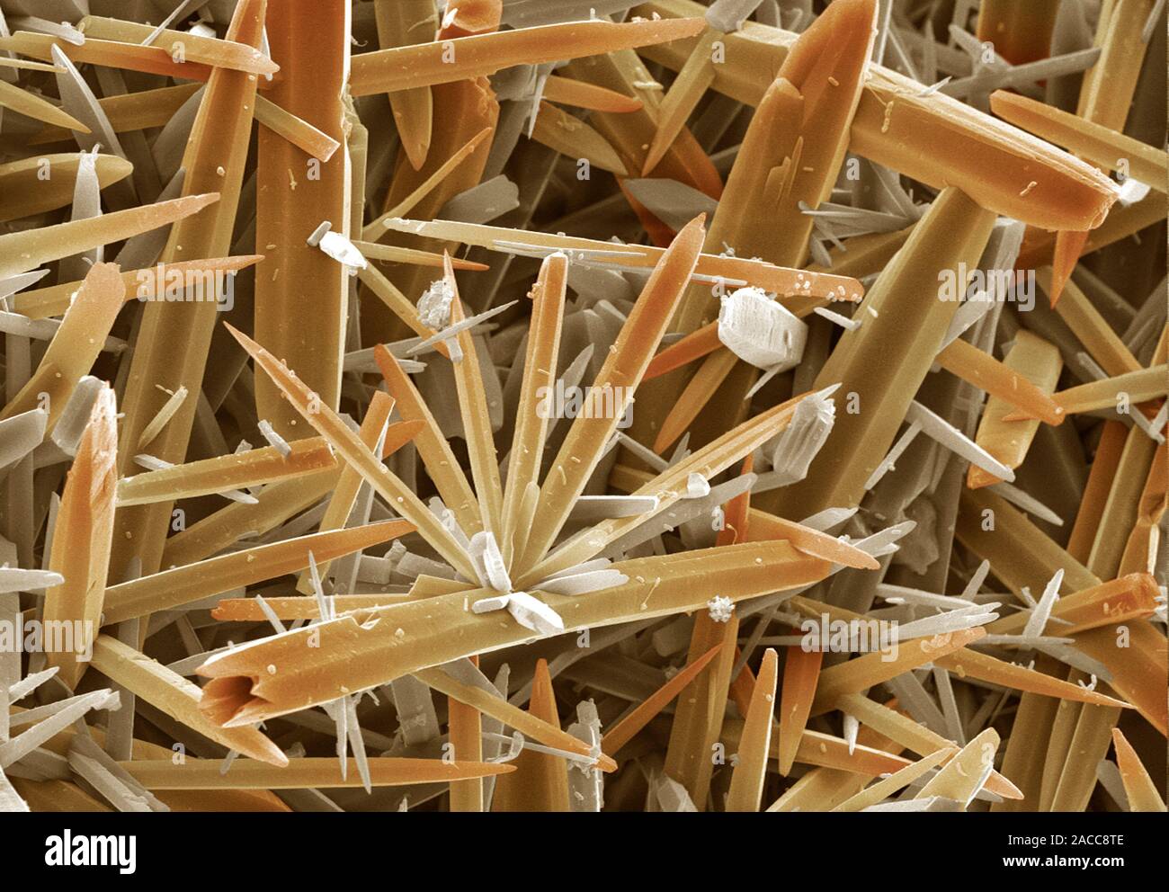Kettle limescale. Coloured scanning electron micrograph (SEM) of fur or