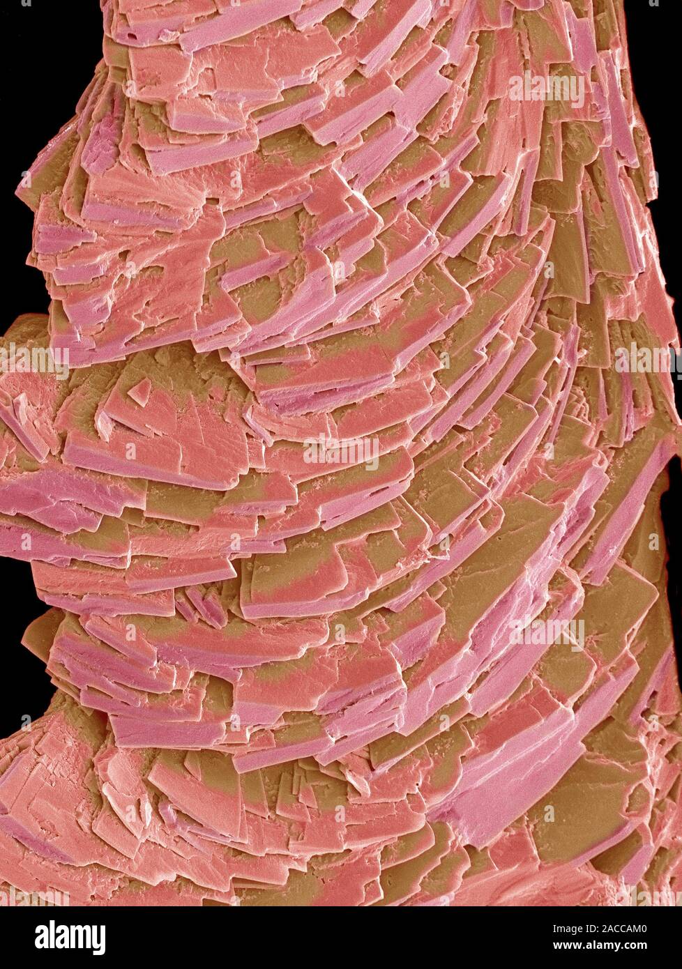 Antihistamine drug crystals, coloured scanning electron micrograph (SEM