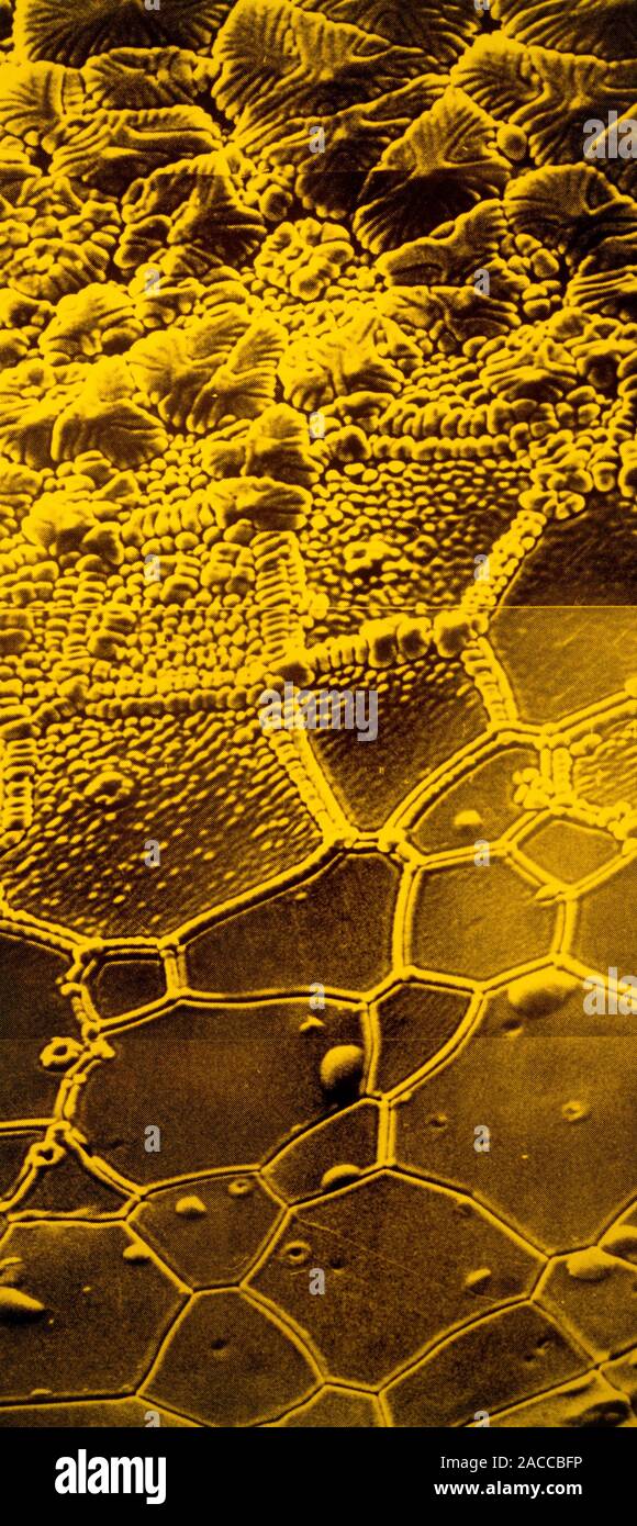 Falsecolour scanning electron micrograph (SEM) of a specimen of
