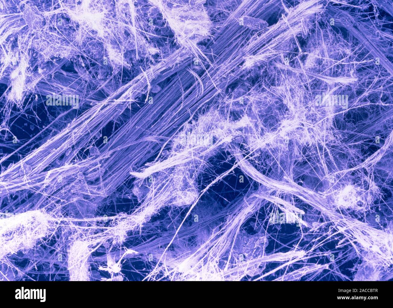 False-colour scanning electron micrograph of fibres of blue asbestos, or crocidolite. All asbestos varieties are silicates (amphibole minerals), the m Stock Photo