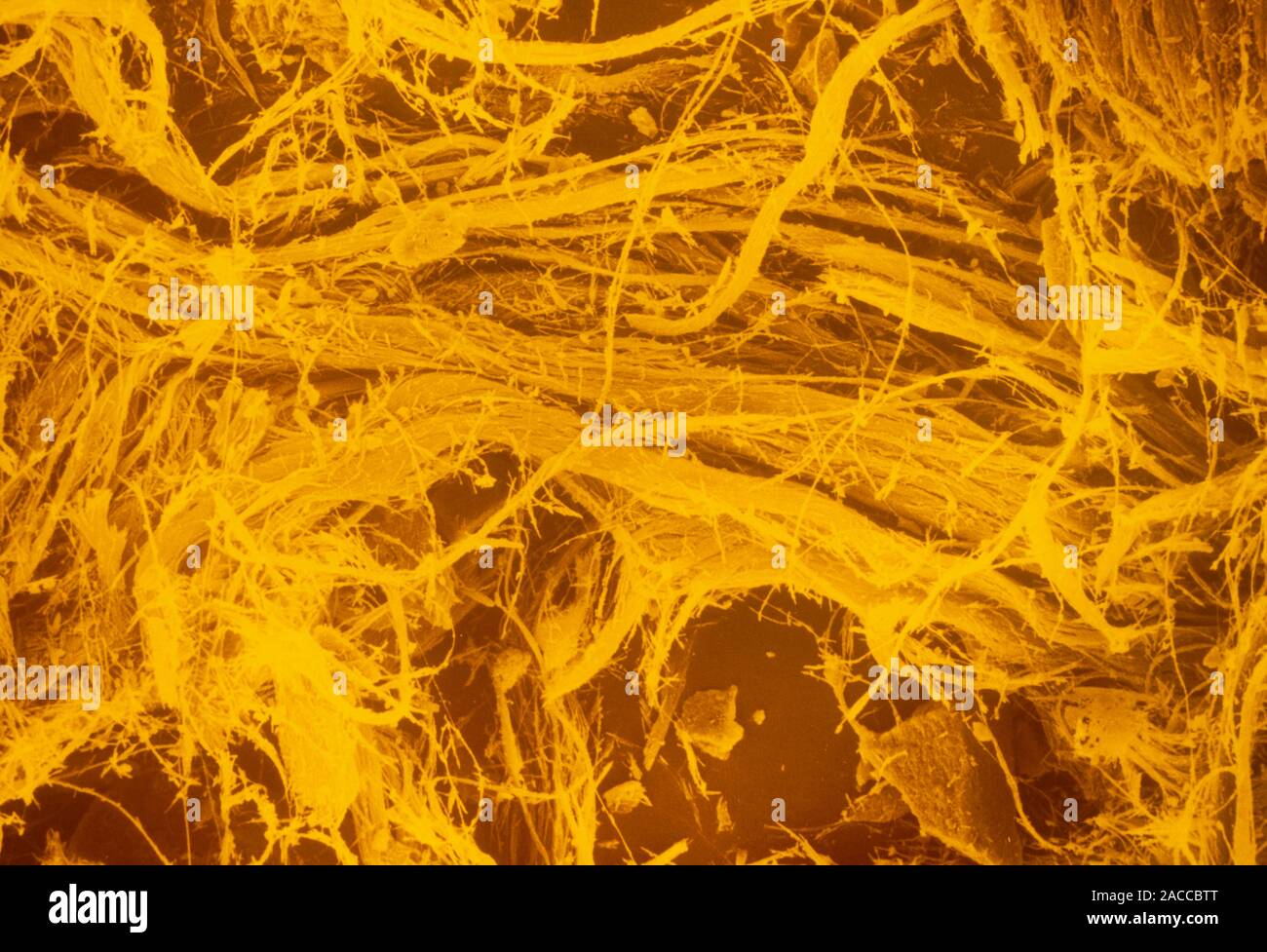 False-colour scanning electron micrograph of fibres of chrysotile, a ...