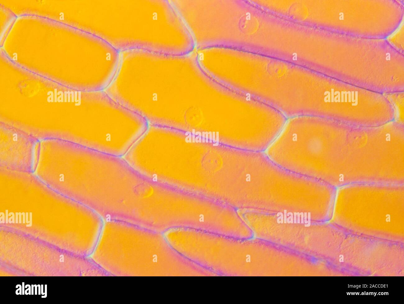 Light micrograph of the epidermis of an onion, showing the bands of