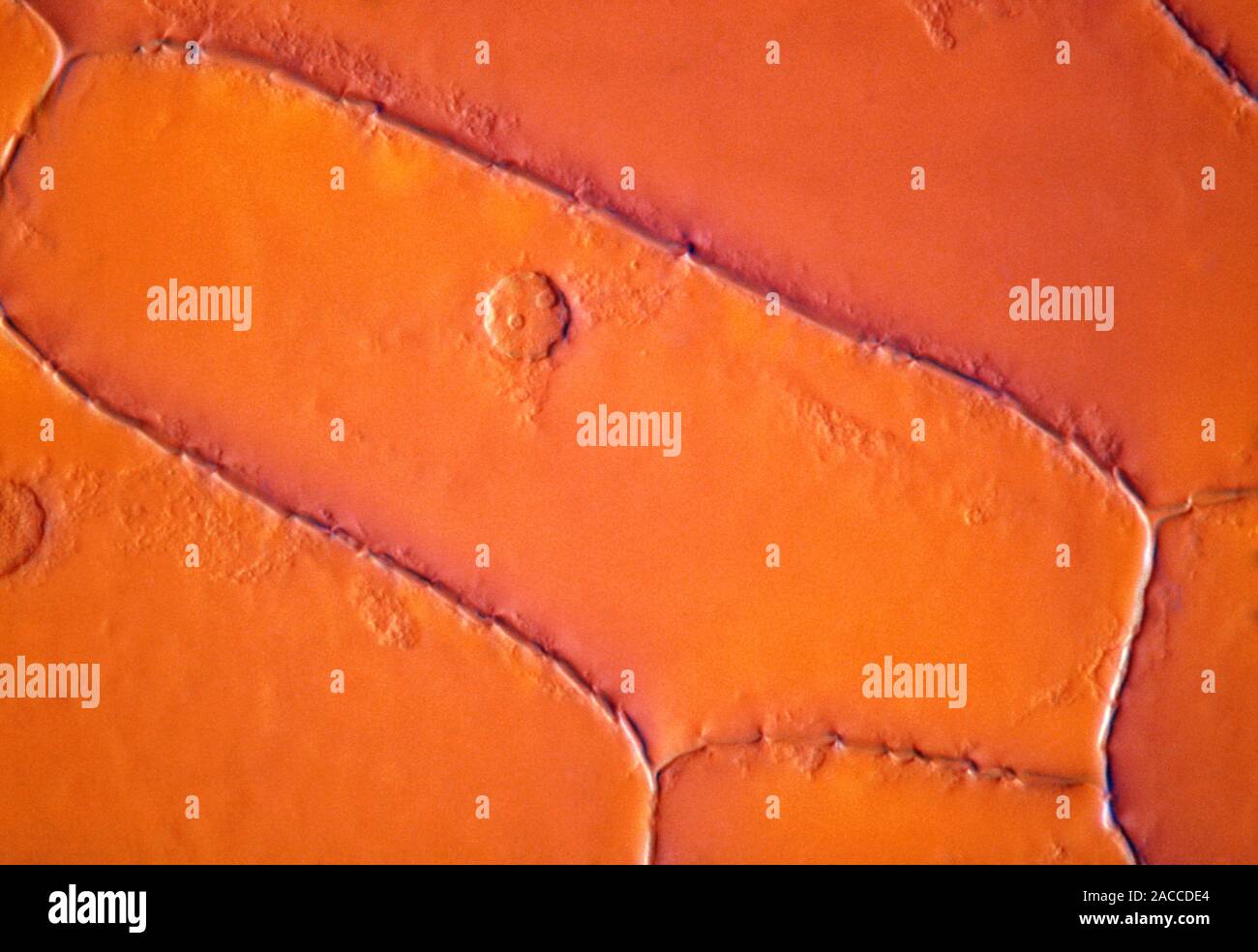 Light micrograph of a cell from the epidermis of an onion, showing the