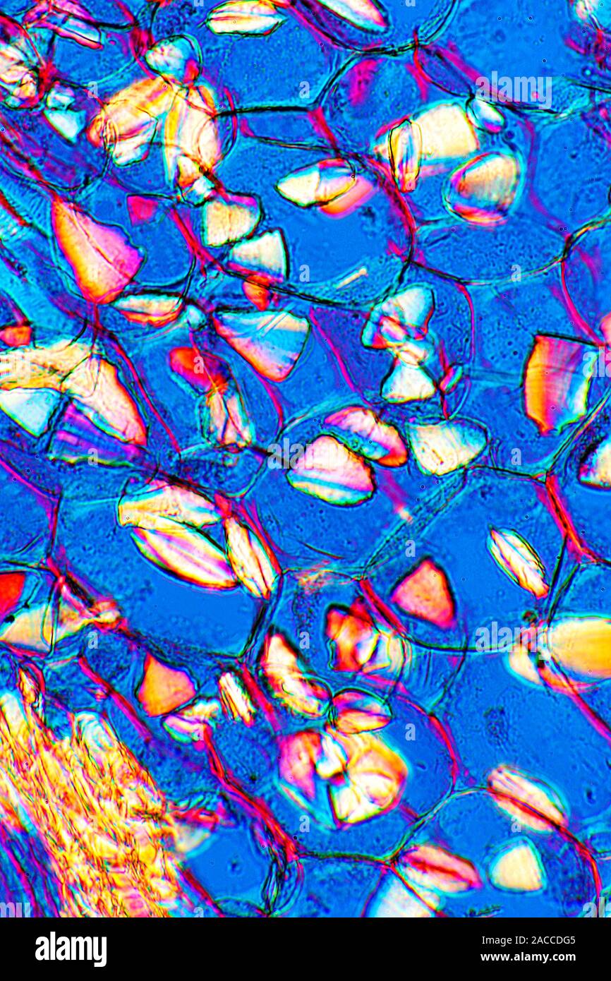 Compound starch grains. Light micrograph of compound starch grains in ...
