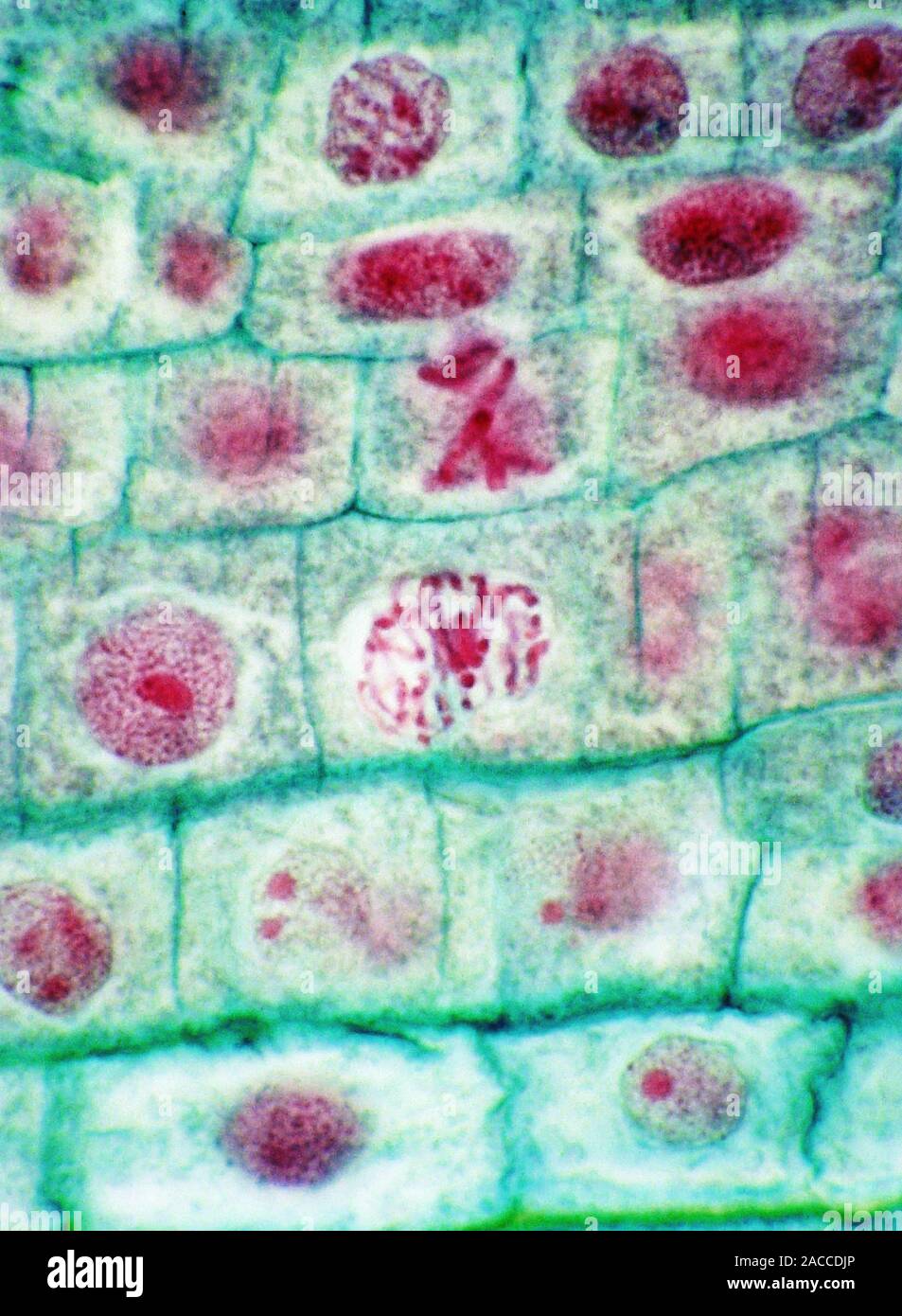 Onion cell mitosis. Light micrograph of the cells in the tip of the ...