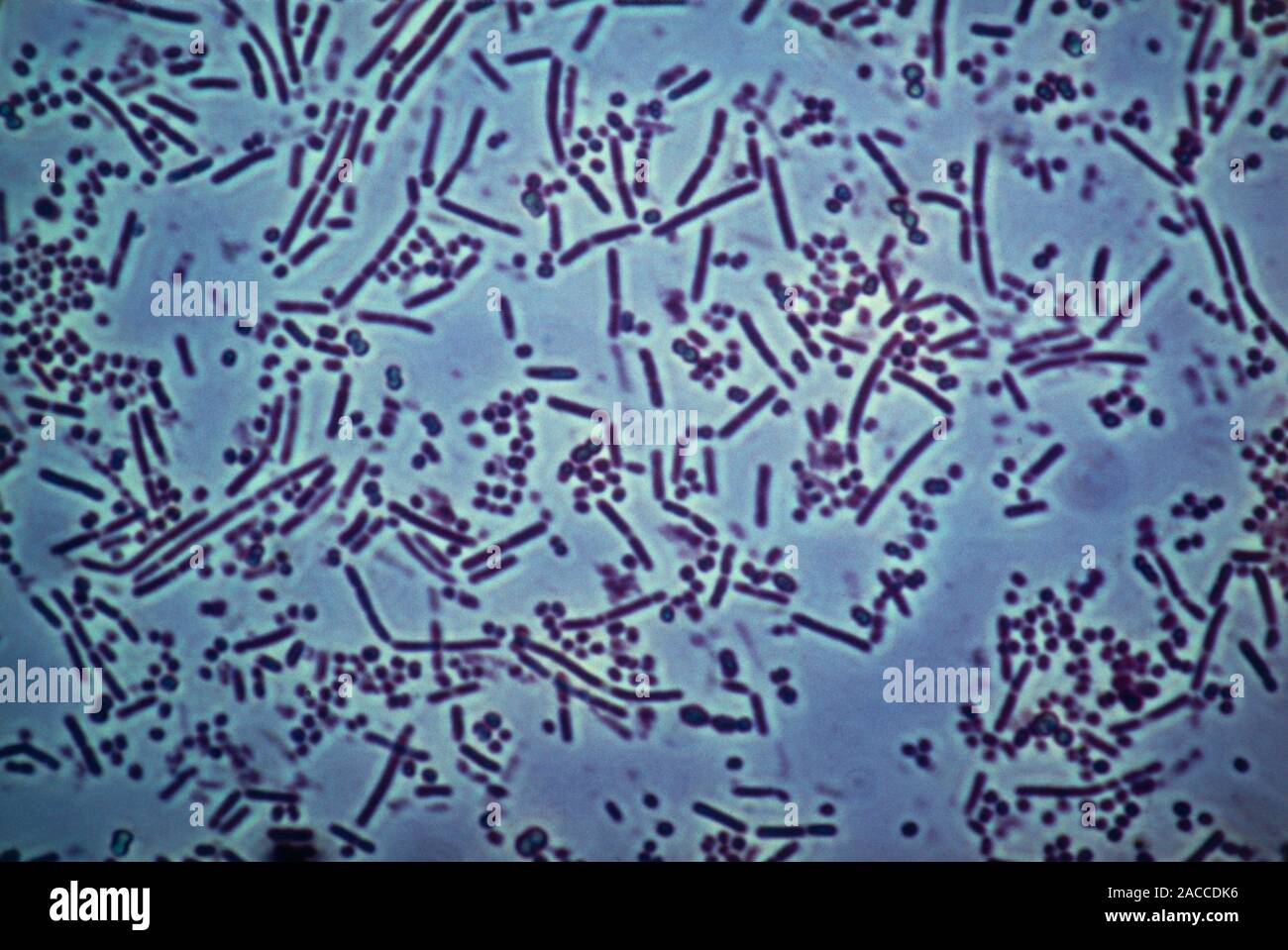 Light micrograph of a population of bacteria taken from the human mouth