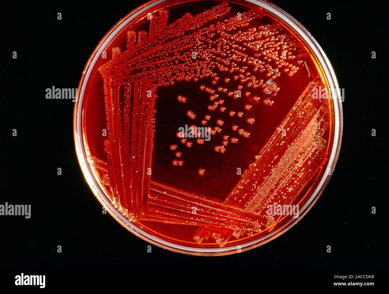 Petri dish culture of colonies of the bacteria salmonella typhi