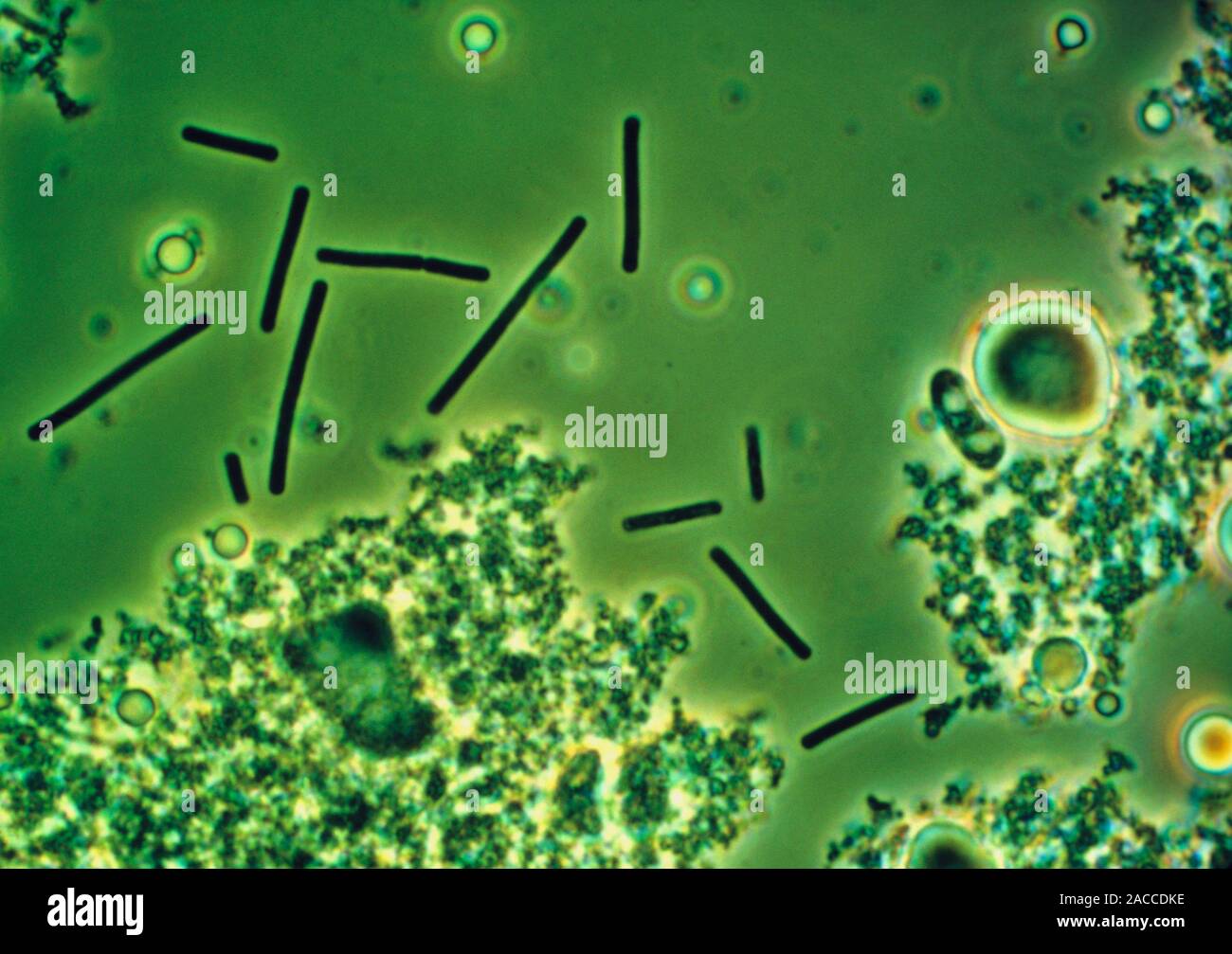 Light micrograph (phase contrast) of Lactobacillus bulgaricus bacteria