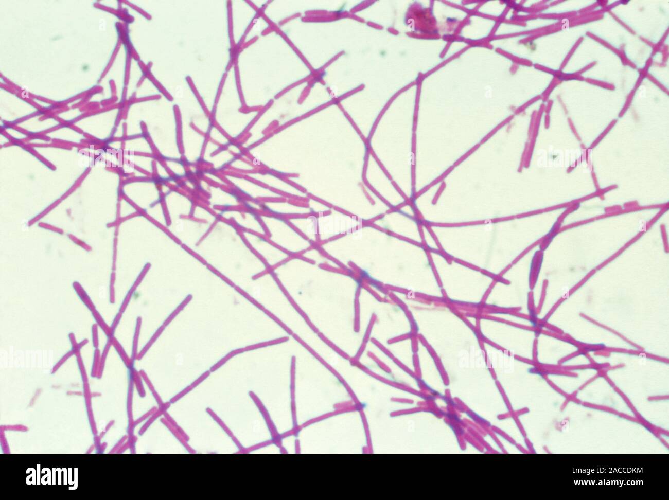 Bacillus anthracis микроскопия. сибиреязвенная бацилла микроскопия. бациллюс anthrax под микроскопом. бацилла антрацис сибирская язва. сибиреязвенная бацилла под микроскопом.